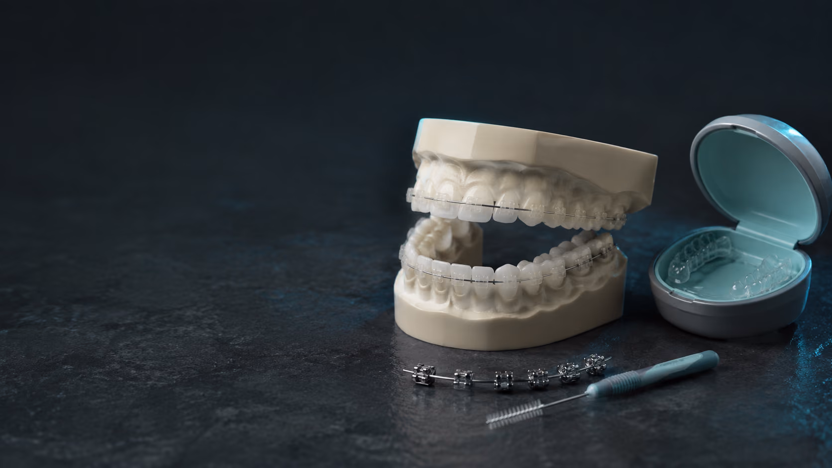Ceramic braces and tooth-colored brackets