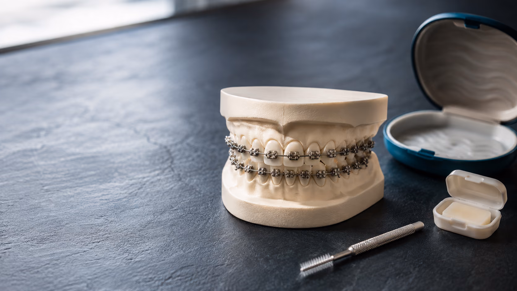 Braces and fixed orthodontic appliances