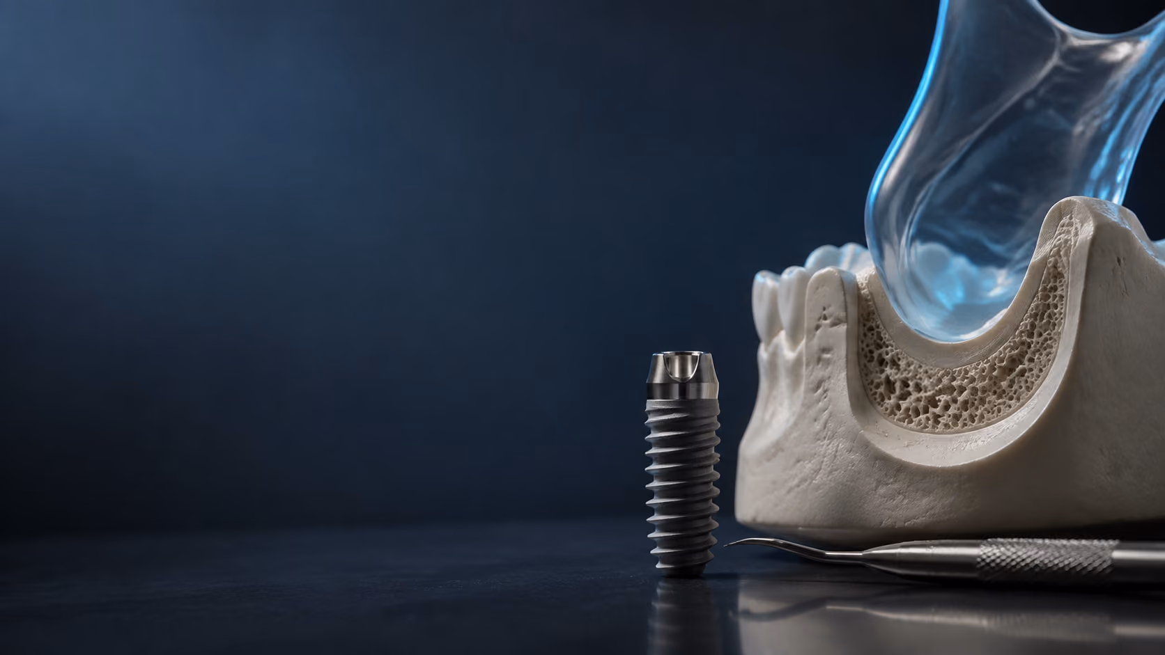 Dental implant beside an anatomical bone study model prepared for site planning